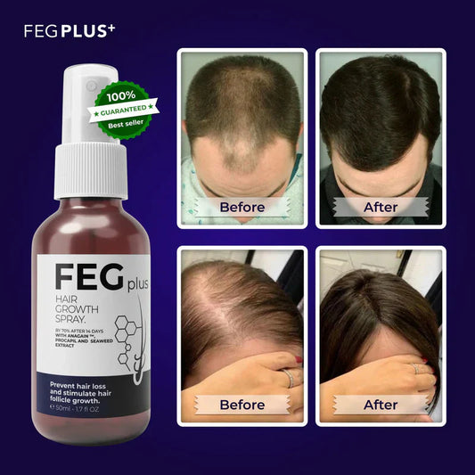 Most Viral FEG Plus Hair Growth Spray